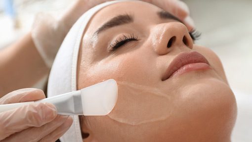 Chemical Peel