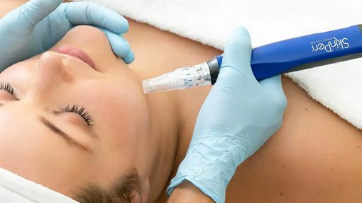 SkinPen Microneedling