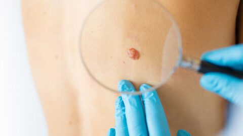 Skin Spot Guide Medical Dermatology Pittsburgh | Skin Solutions Dermatology